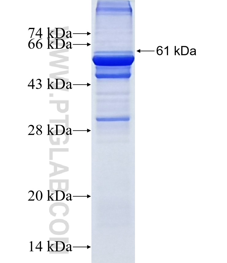 CRAT fusion protein Ag7422 SDS-PAGE