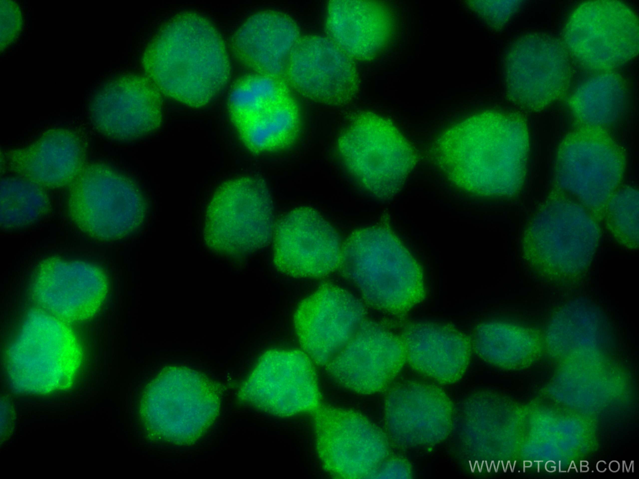 IF Staining of COLO 320 using 28494-1-AP