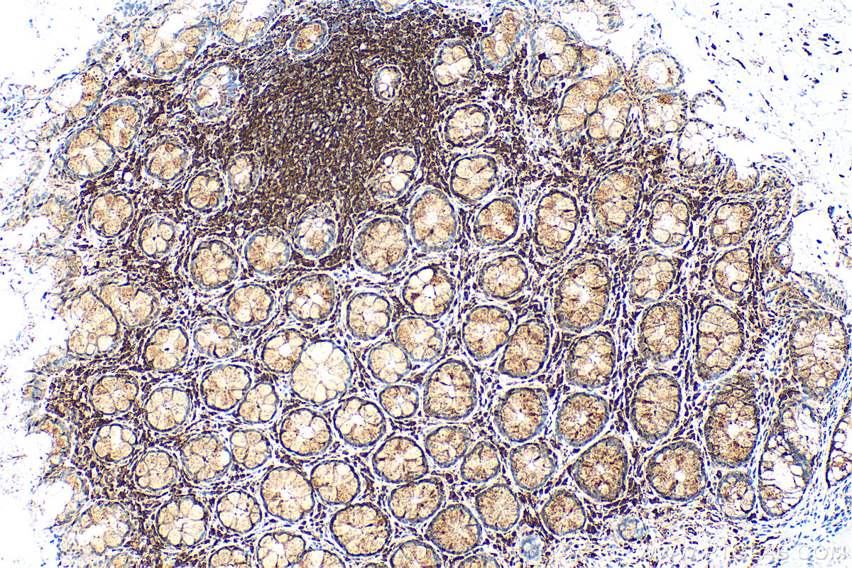 IHC staining of human colon using 83340-3-RR (same clone as 83340-3-PBS)