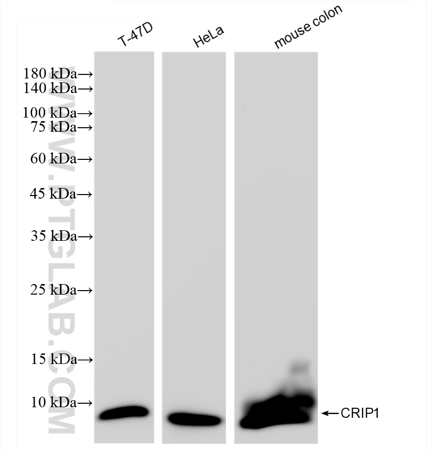 WB analysis using 83340-3-RR (same clone as 83340-3-PBS)