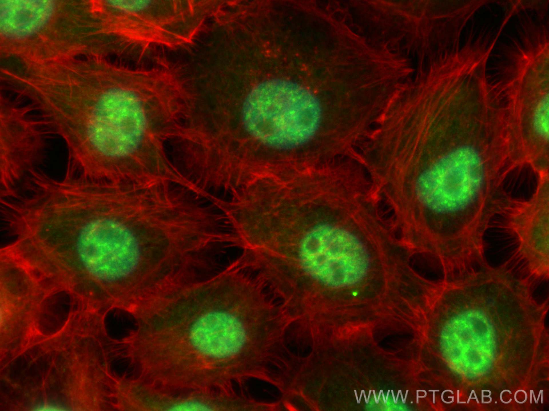 IF Staining of A431 using 26816-1-AP