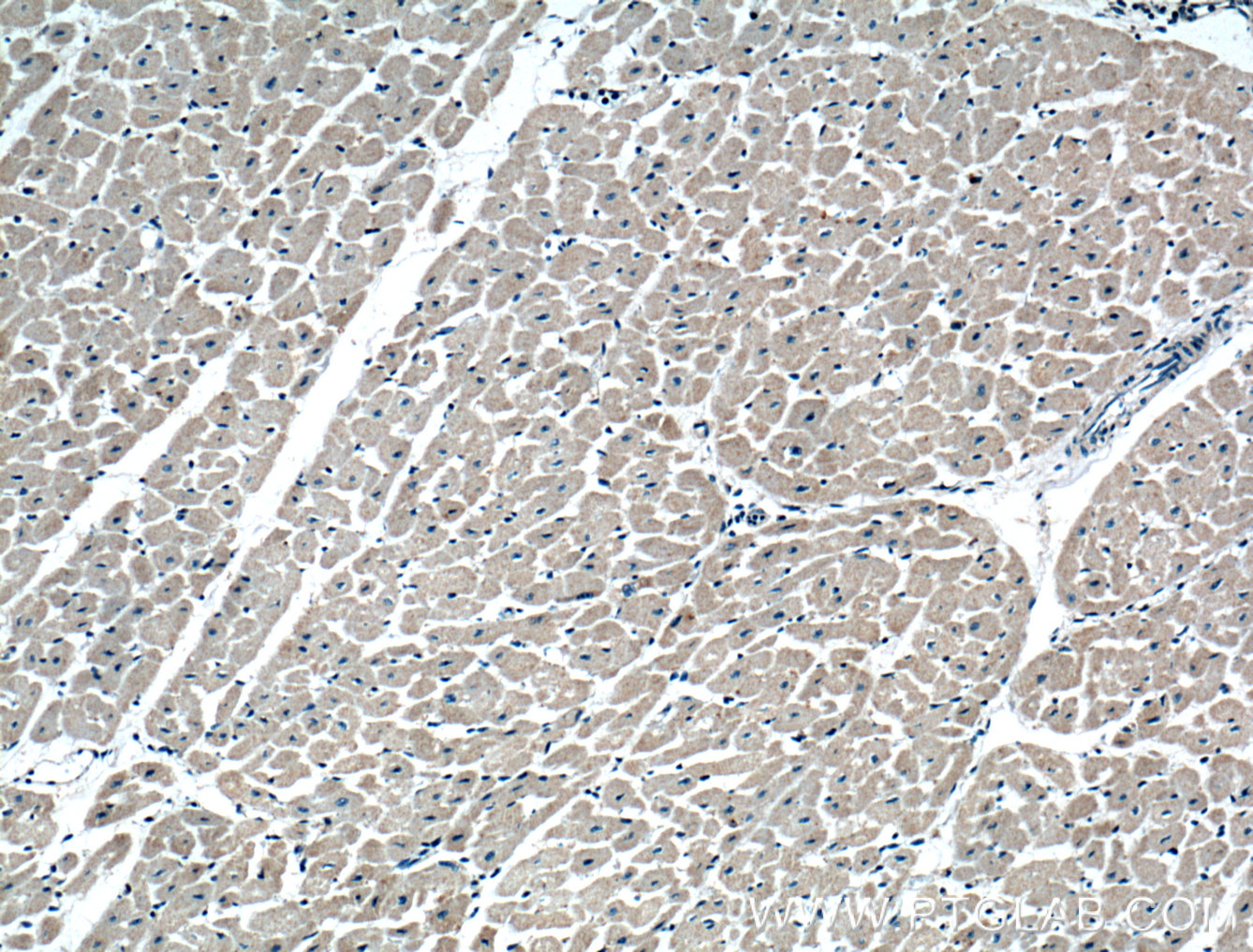 IHC staining of human heart using 51055-1-AP