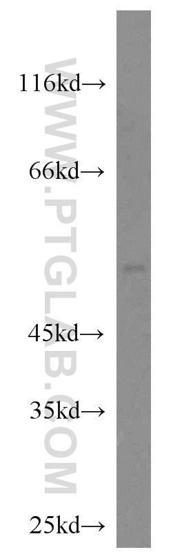 WB analysis of mouse heart using 51055-1-AP