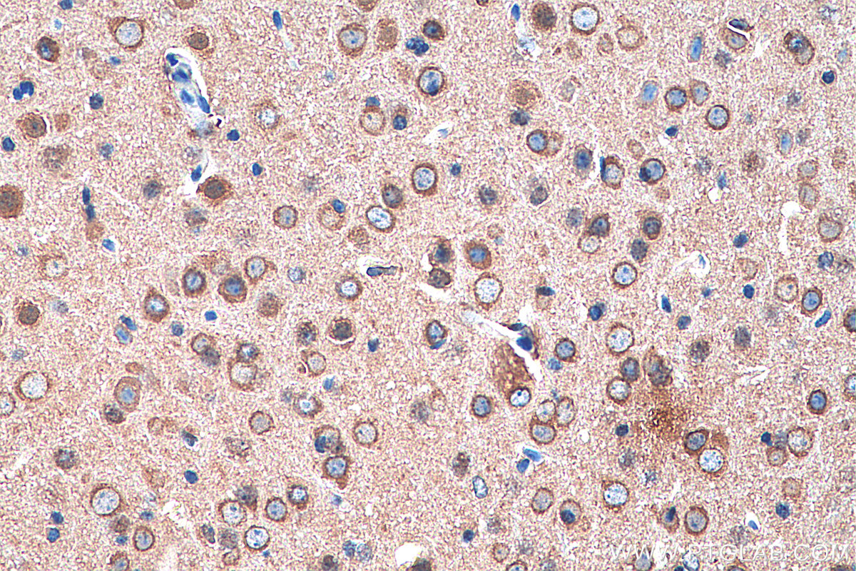 IHC staining of mouse brain using 68021-1-Ig (same clone as 68021-1-PBS)