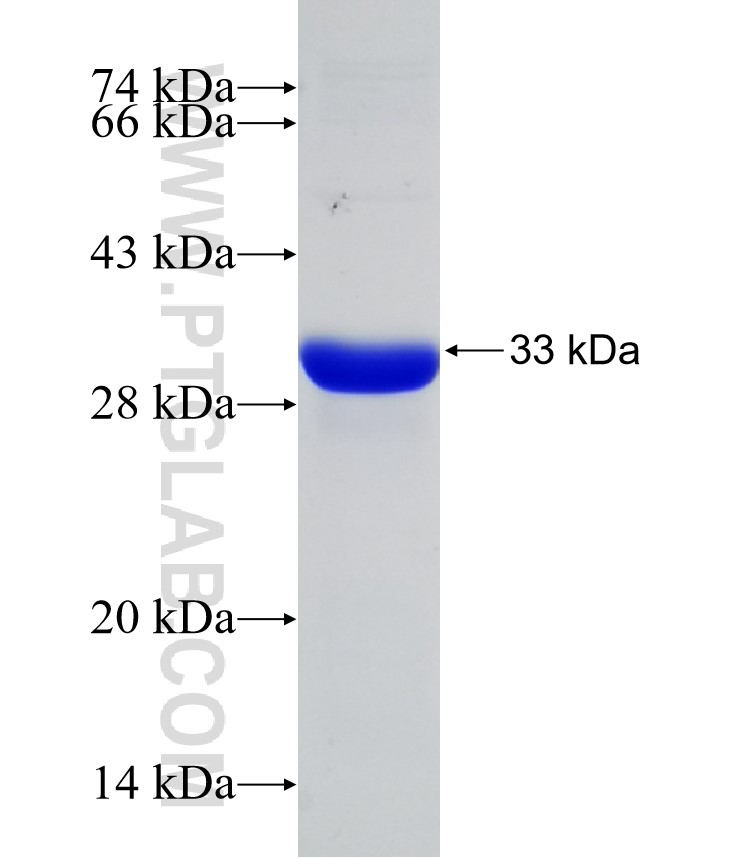 CRMP1 fusion protein Ag31574 SDS-PAGE