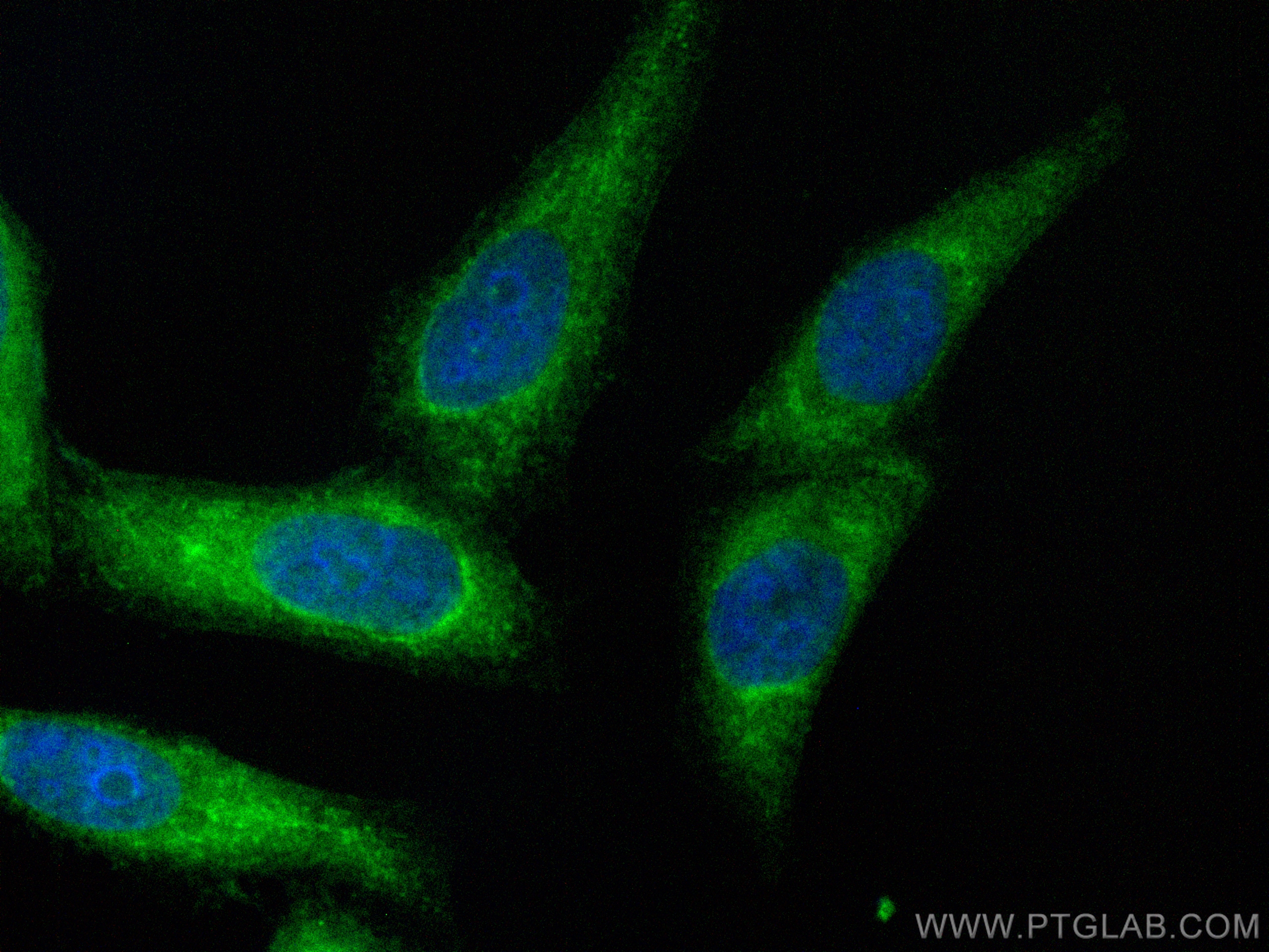 IF Staining of HepG2 using CL488-14686