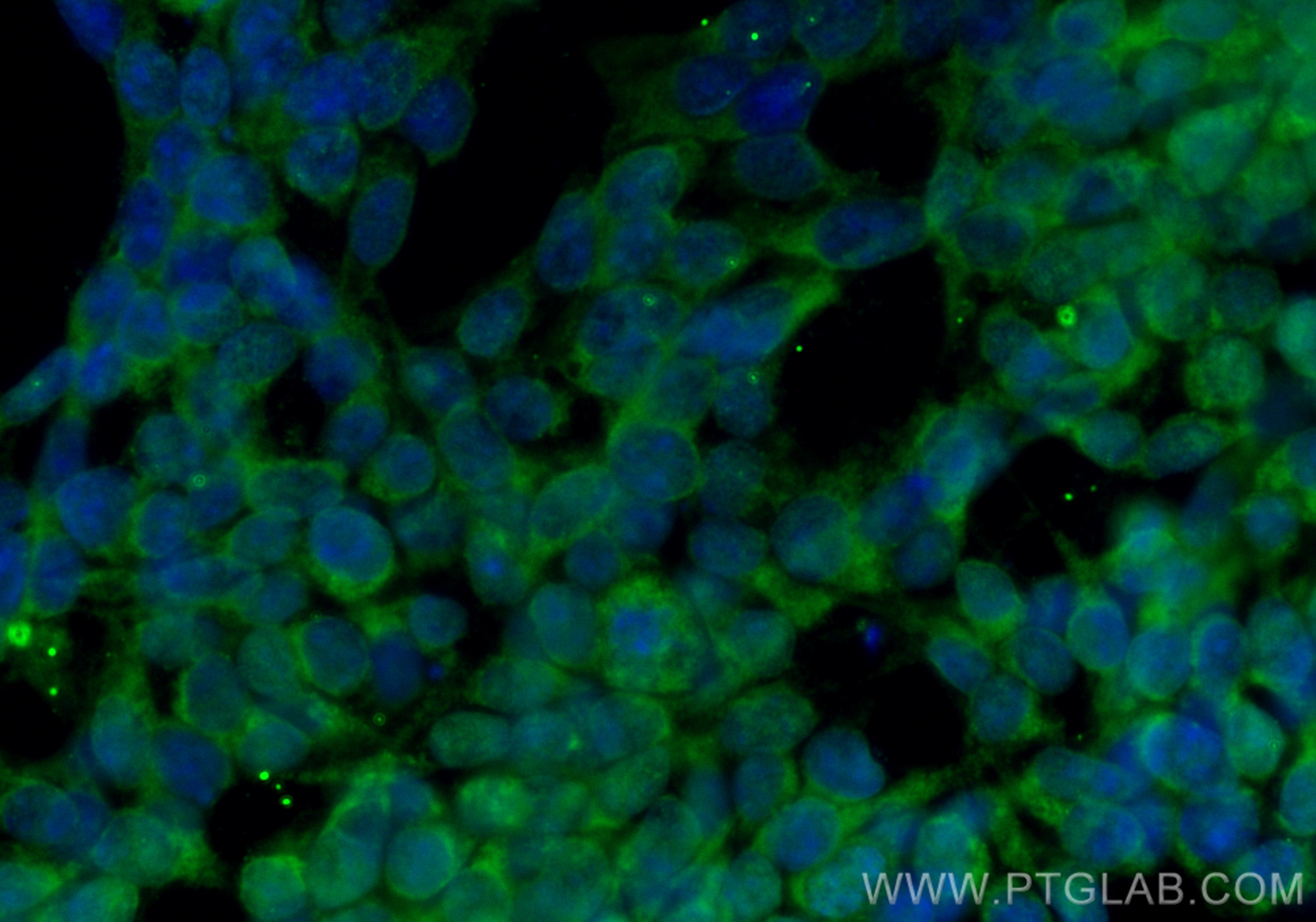 IF Staining of SH-SY5Y using CL488-68272