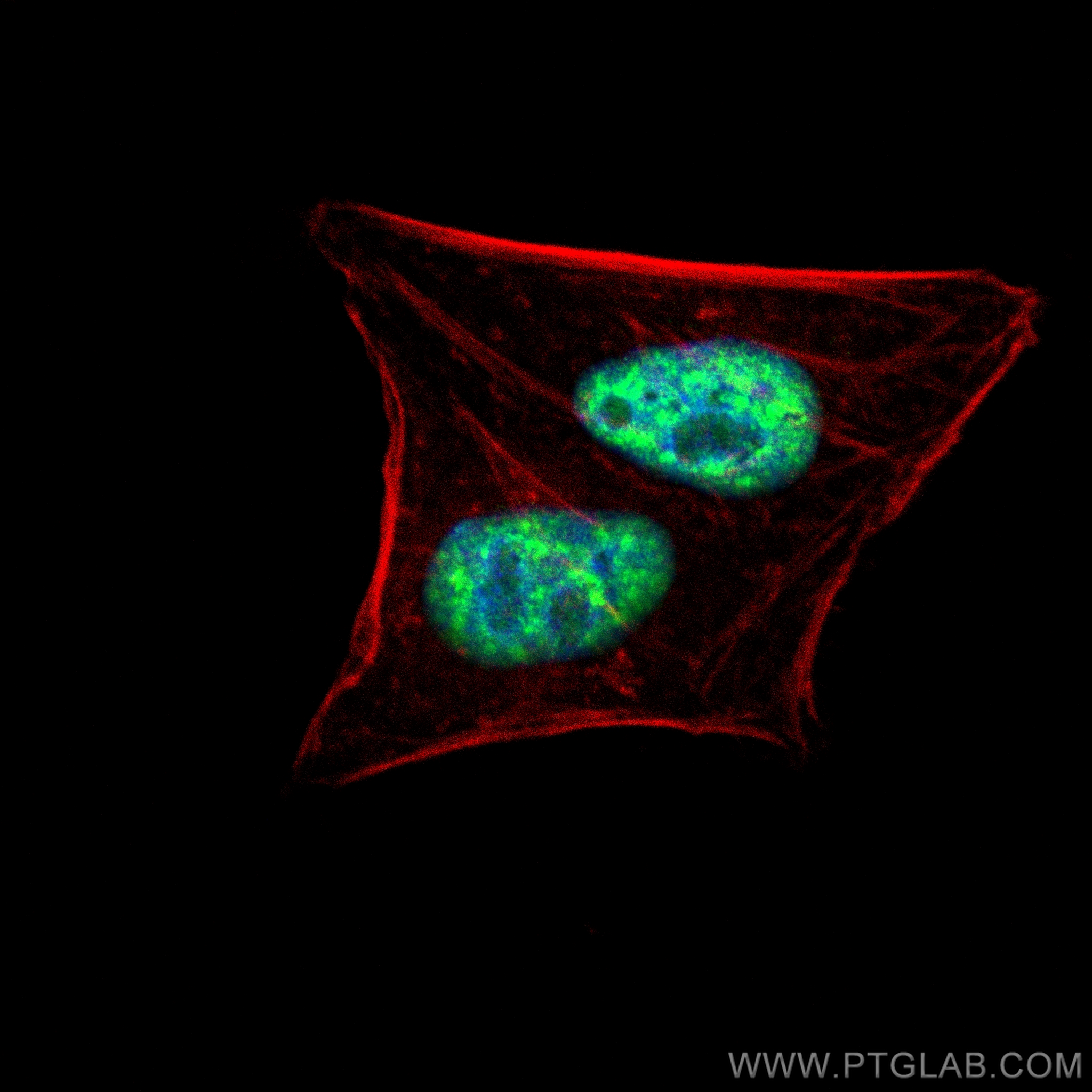 IF Staining of HepG2 using 14504-1-AP