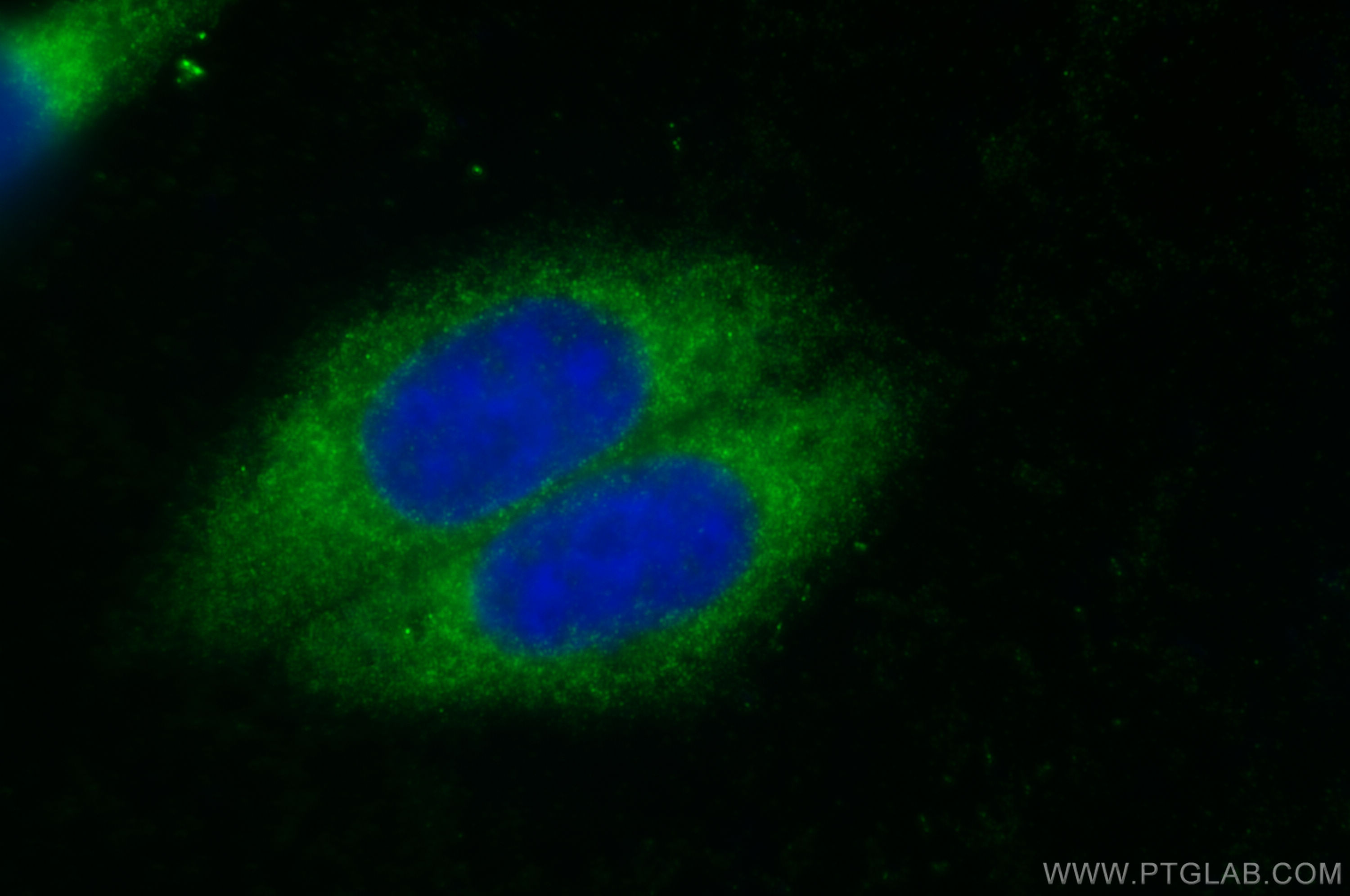 IF Staining of HepG2 using 13543-1-AP