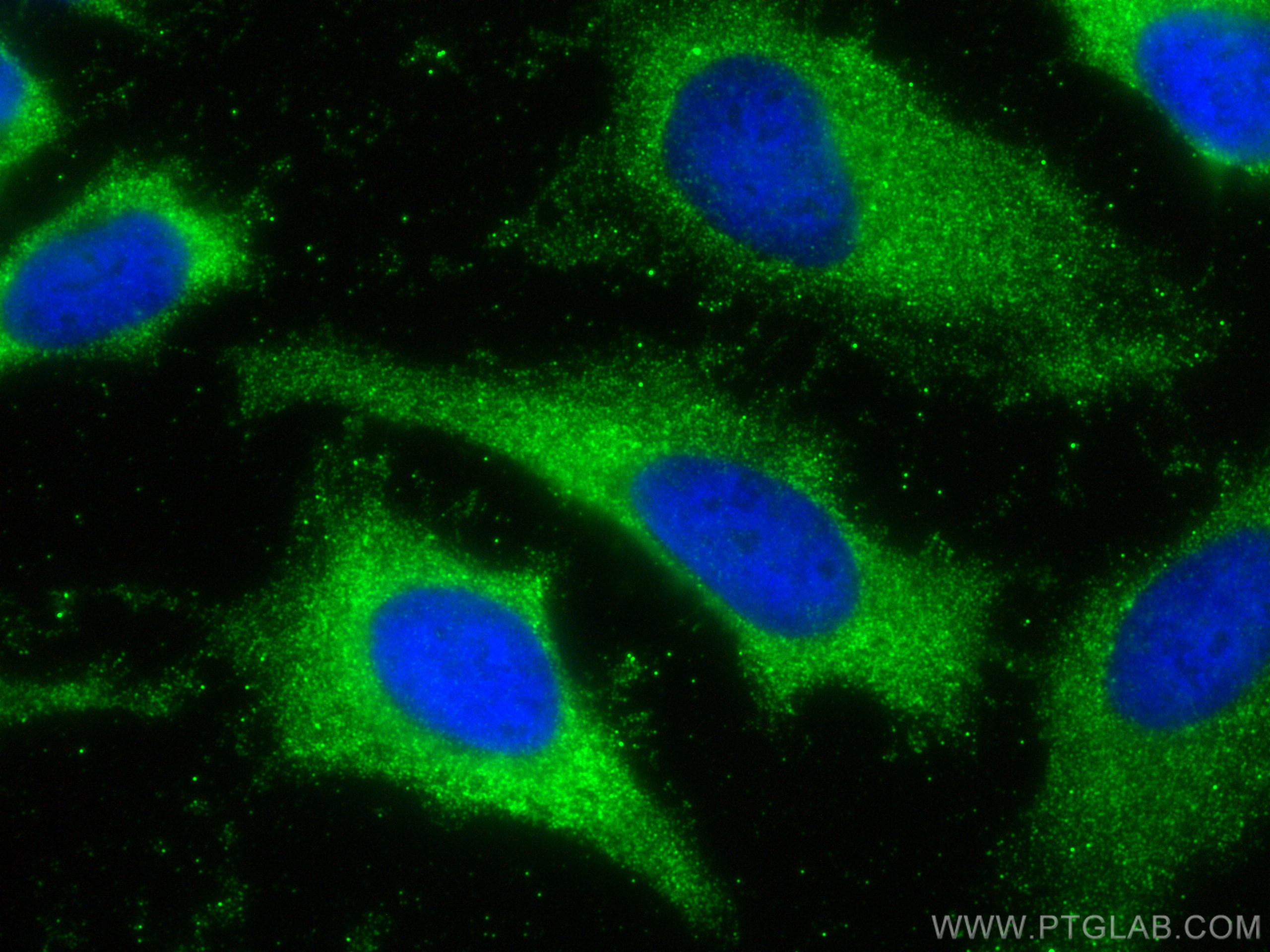 IF Staining of HeLa using 68276-1-Ig (same clone as 68276-1-PBS)