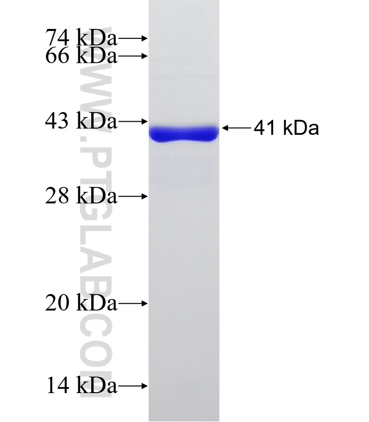 CRTAC1 fusion protein Ag32963 SDS-PAGE