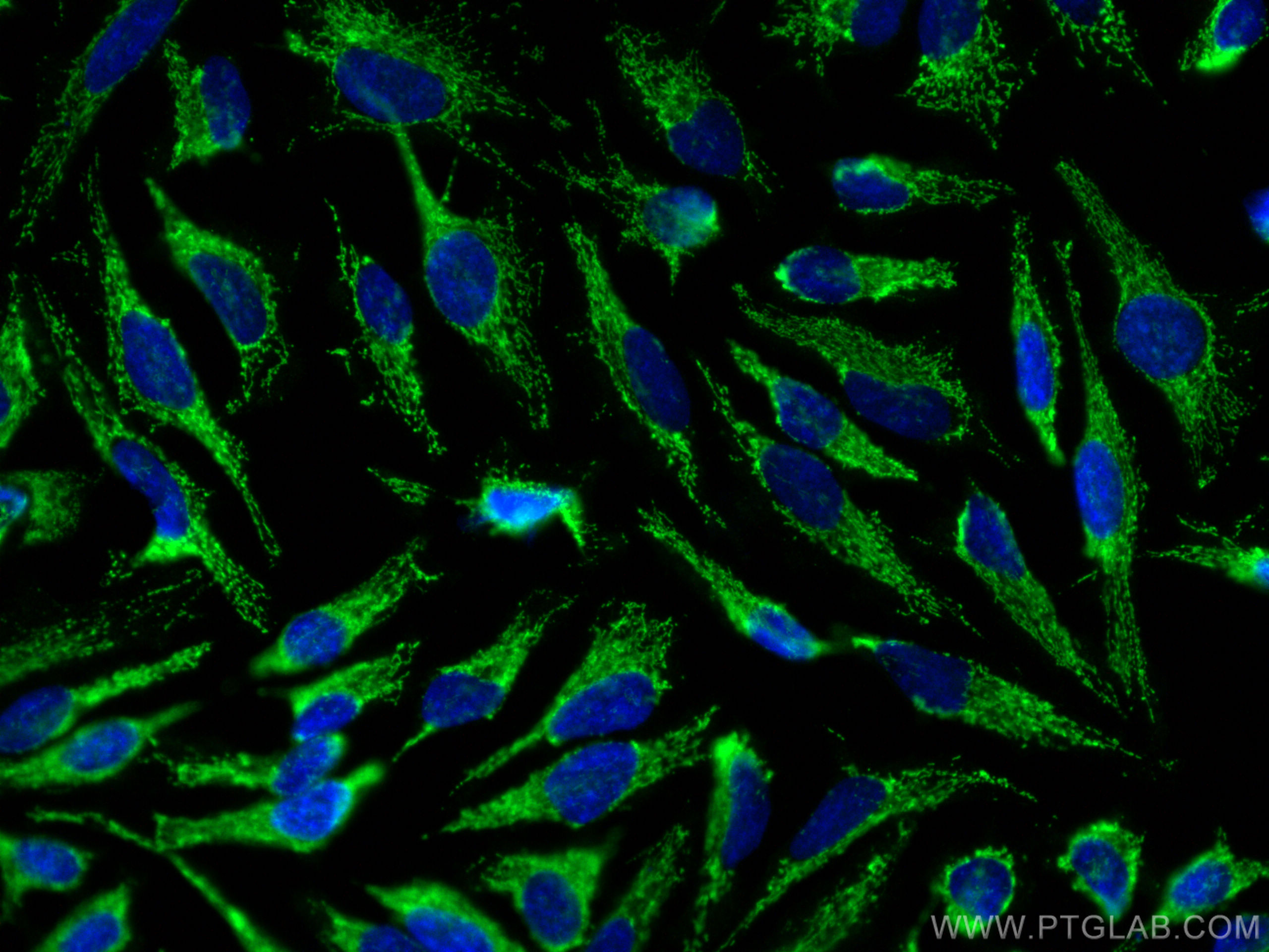 IF Staining of HeLa using 13474-1-AP