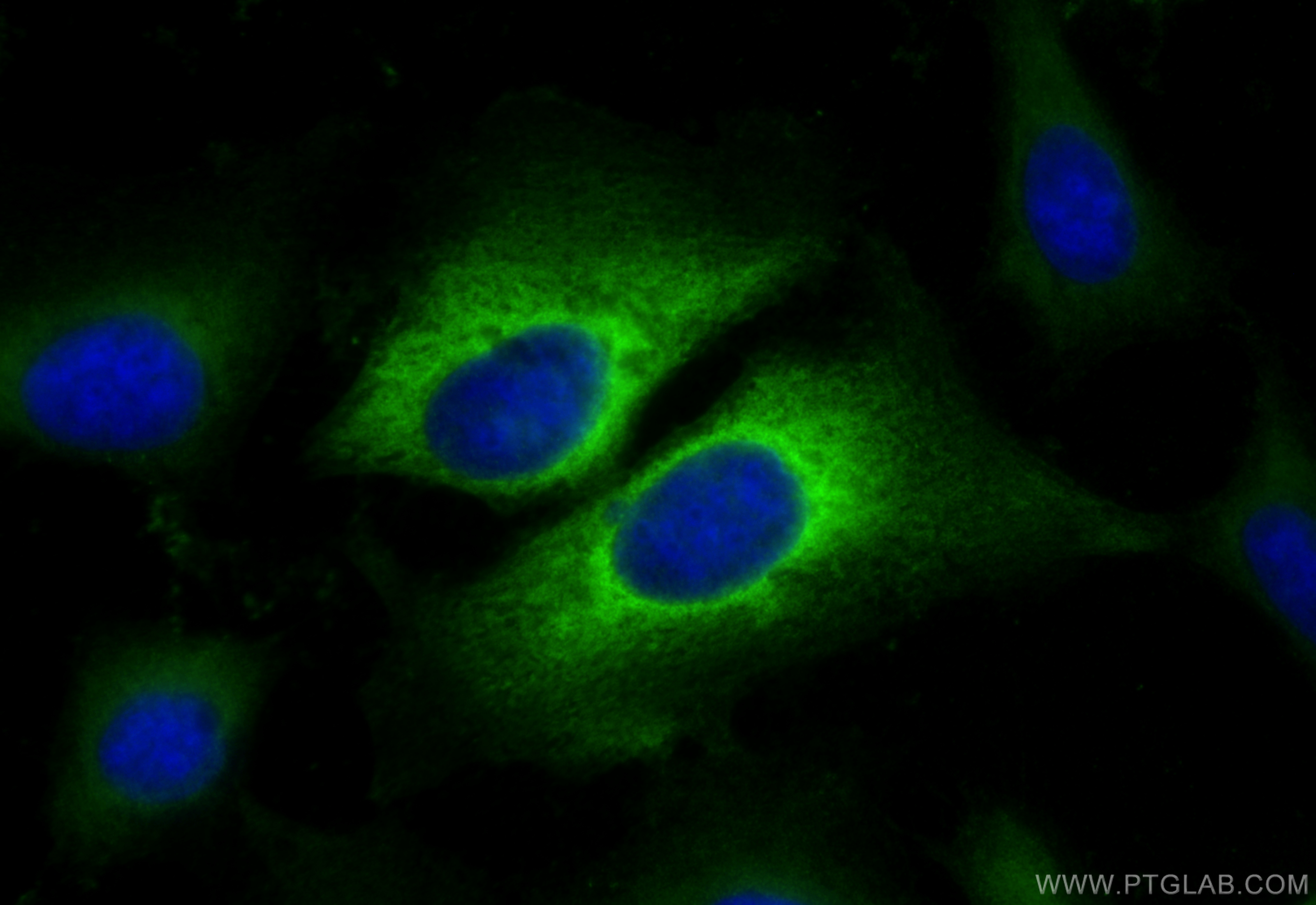 IF Staining of U2OS using 15808-1-AP