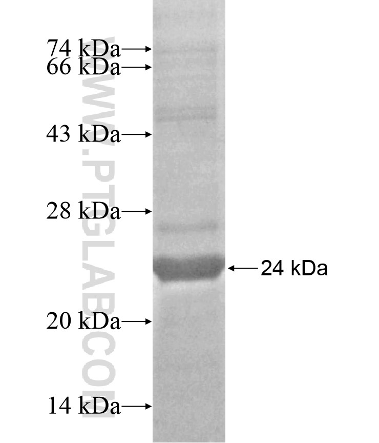 CRYGN fusion protein Ag17178 SDS-PAGE