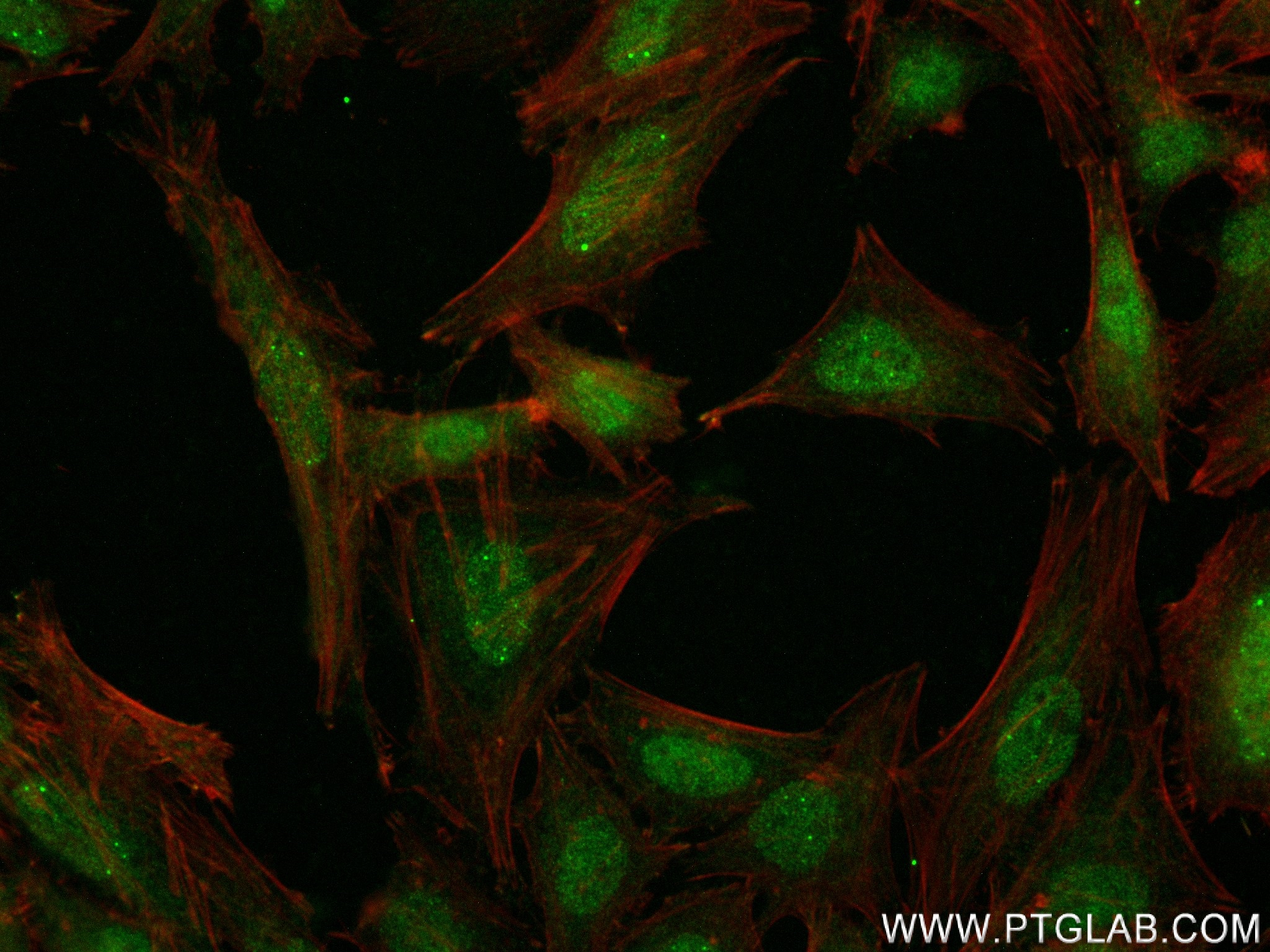 IF Staining of HeLa using 83886-6-RR (same clone as 83886-6-PBS)