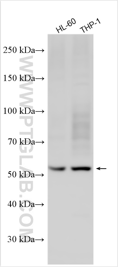 WB analysis using 18307-1-AP