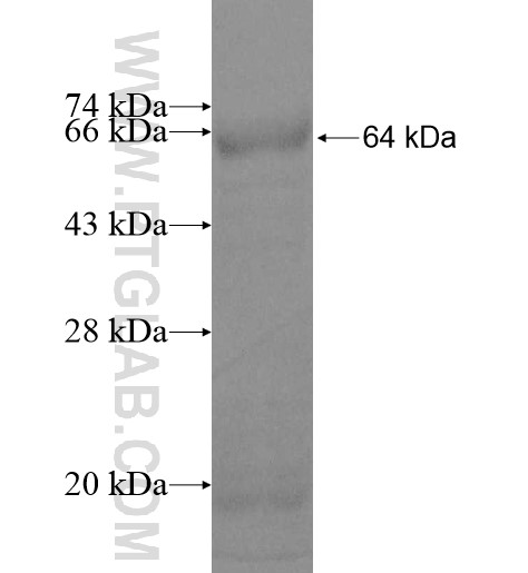 CSGALNACT2 fusion protein Ag11436 SDS-PAGE
