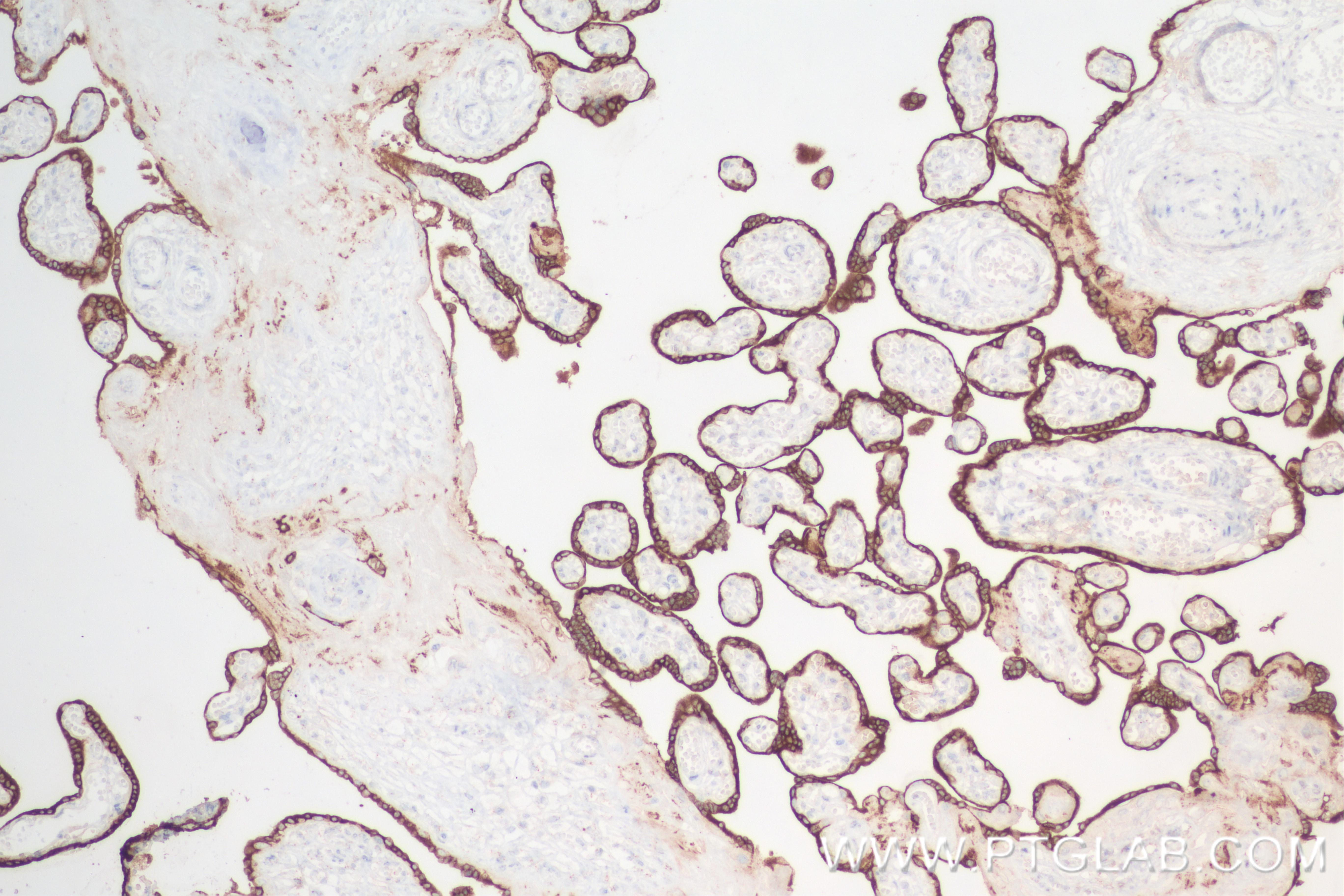 IHC staining of human placenta using 84361-2-RR