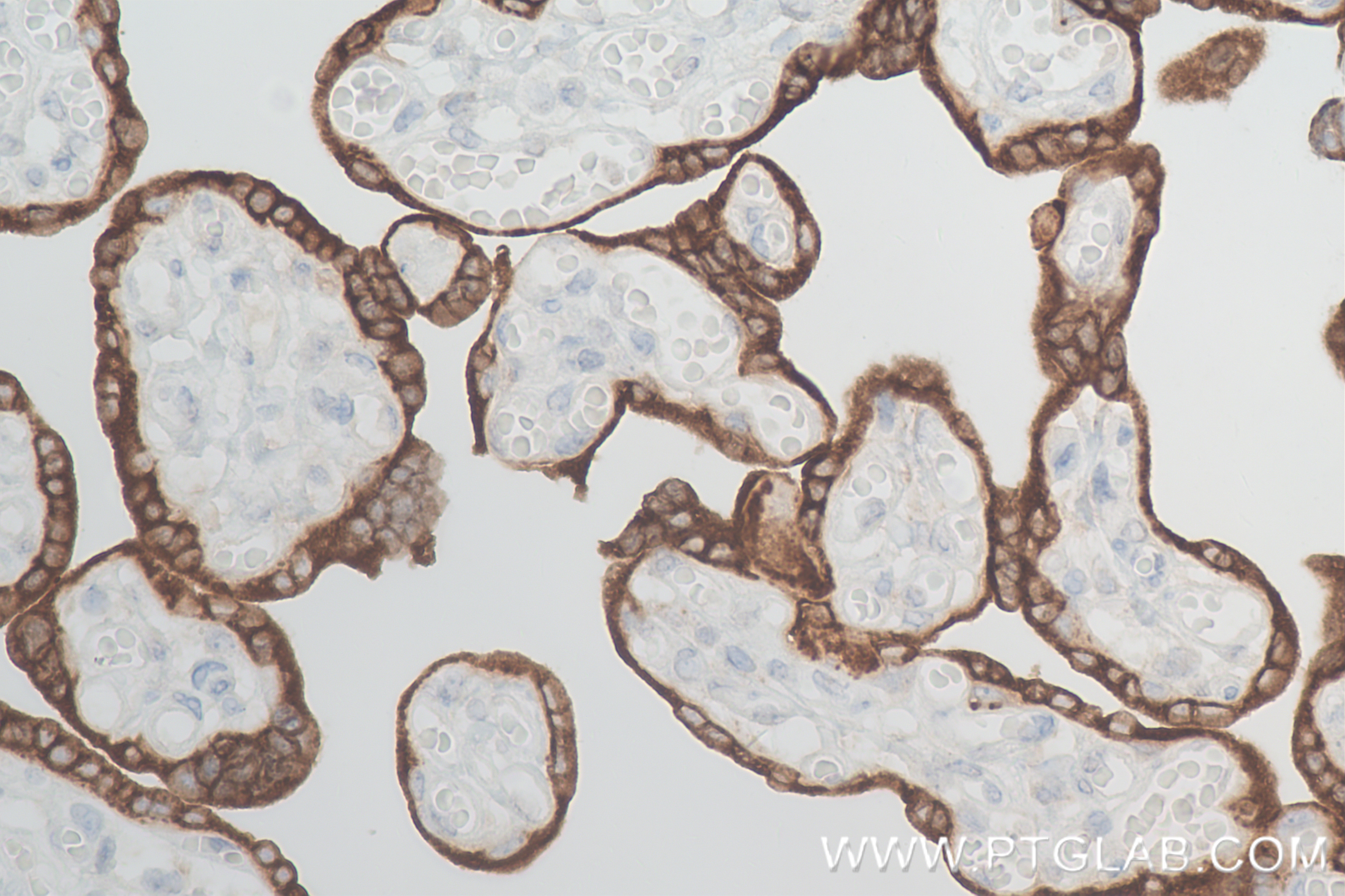 IHC staining of human placenta using 84361-2-RR