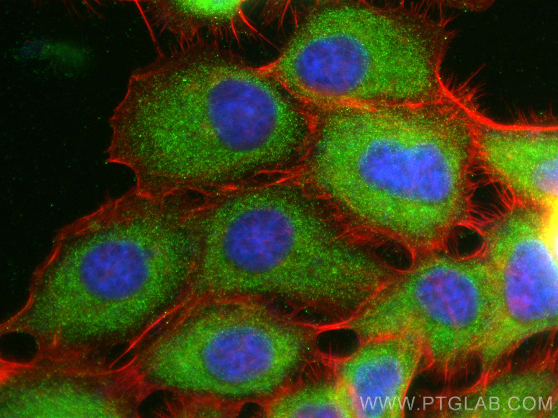 IF Staining of A431 using 17720-1-AP