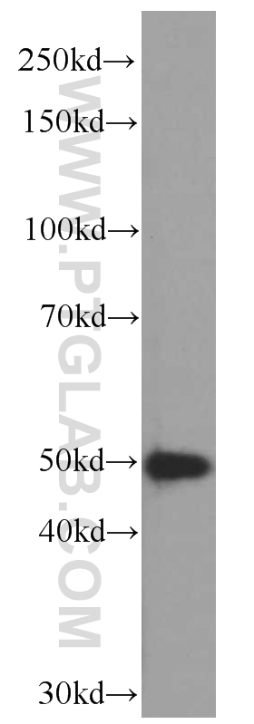 WB analysis of Jurkat using 66115-1-Ig