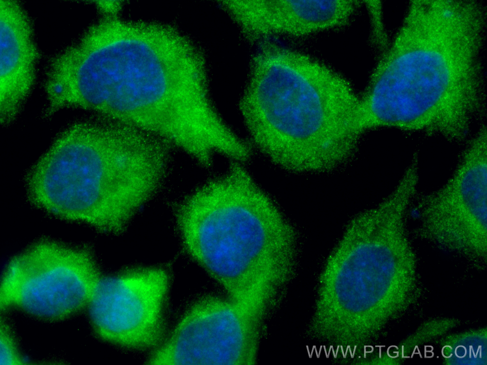 IF Staining of A431 using CL488-17720