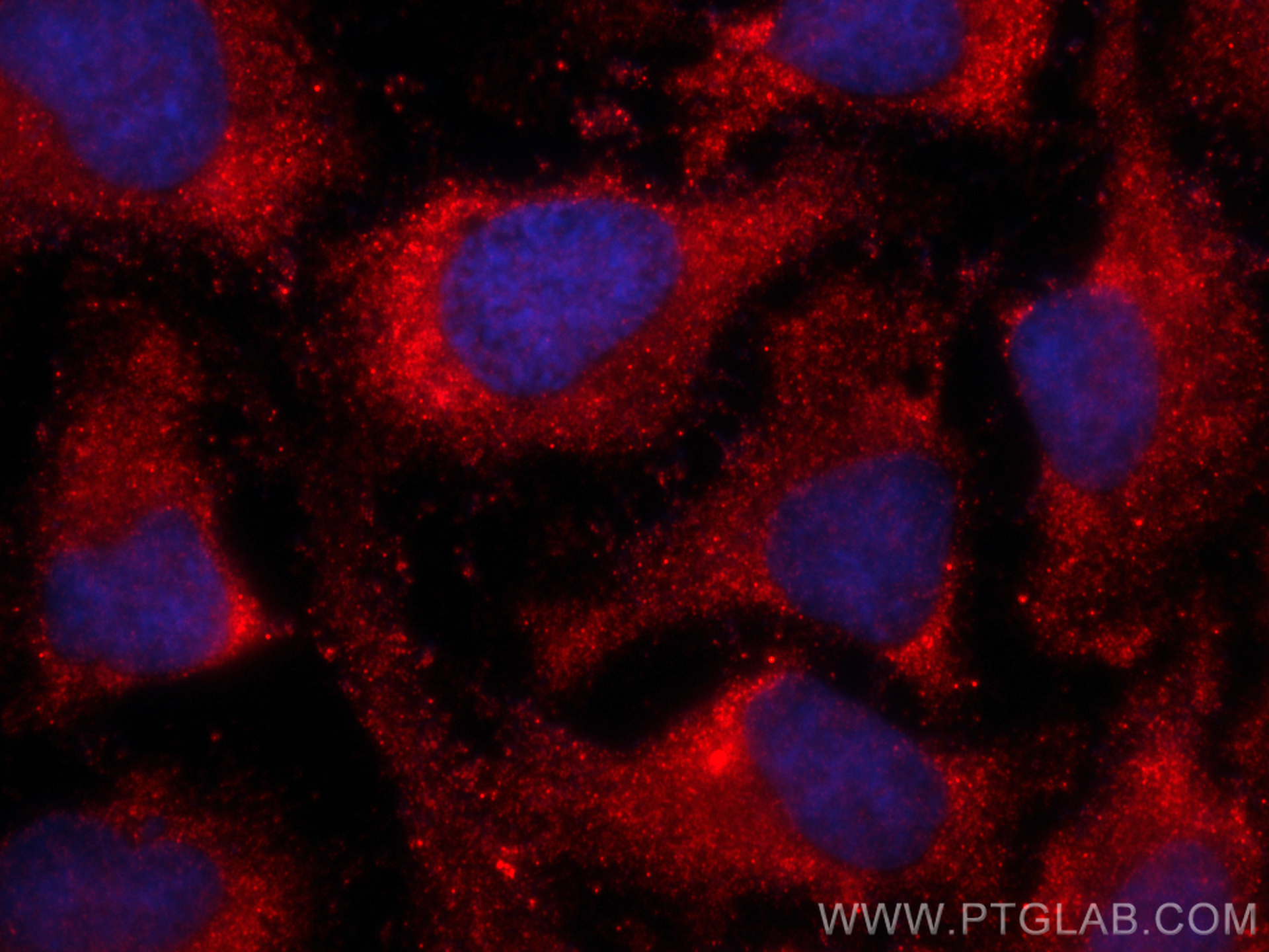 IF Staining of HeLa using CL594-66115