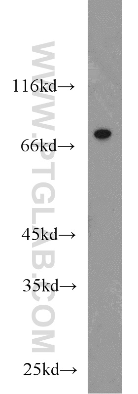 WB analysis of HeLa using 17125-1-AP