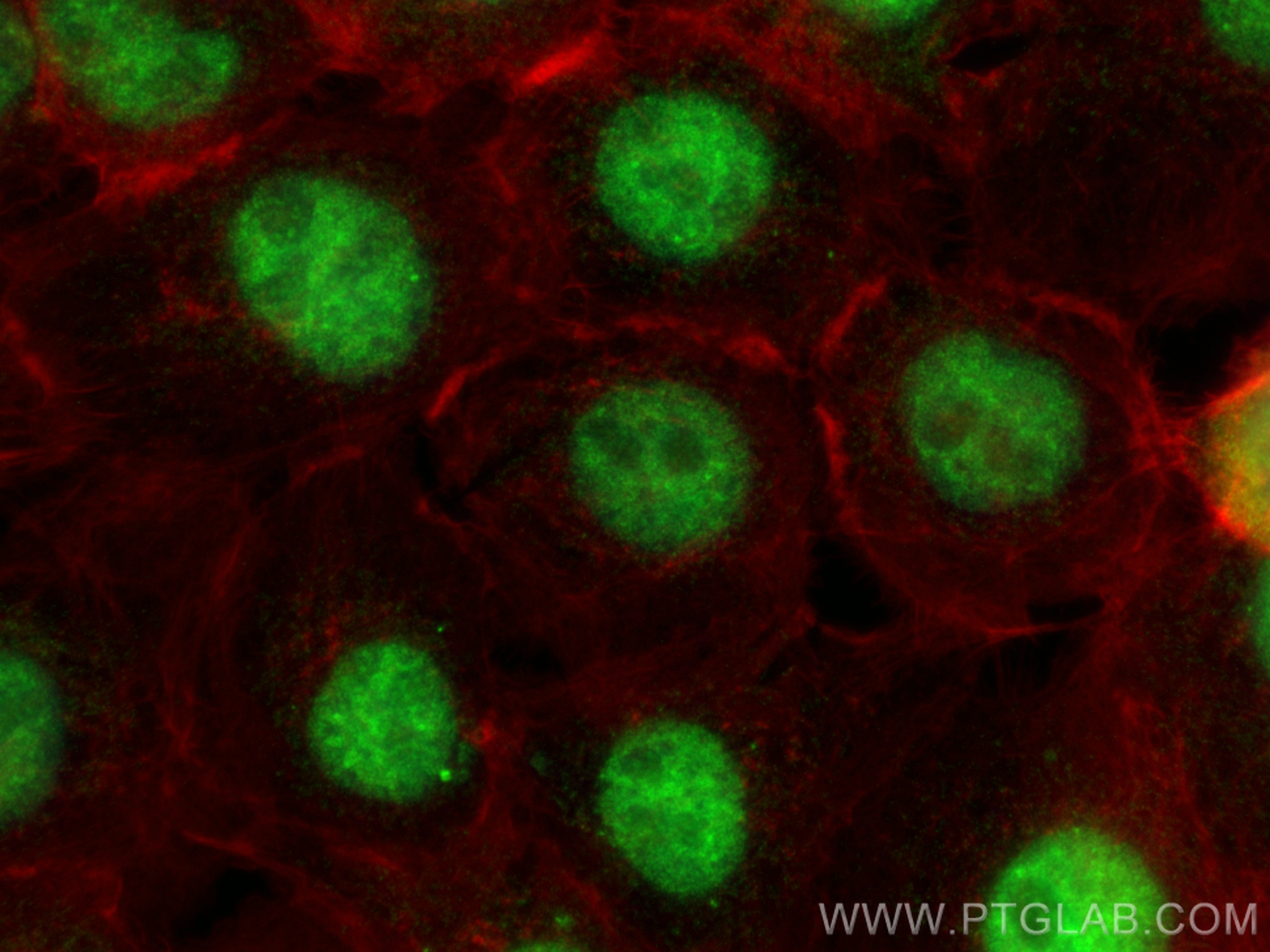 IF Staining of A431 using 68200-1-Ig (same clone as 68200-1-PBS)