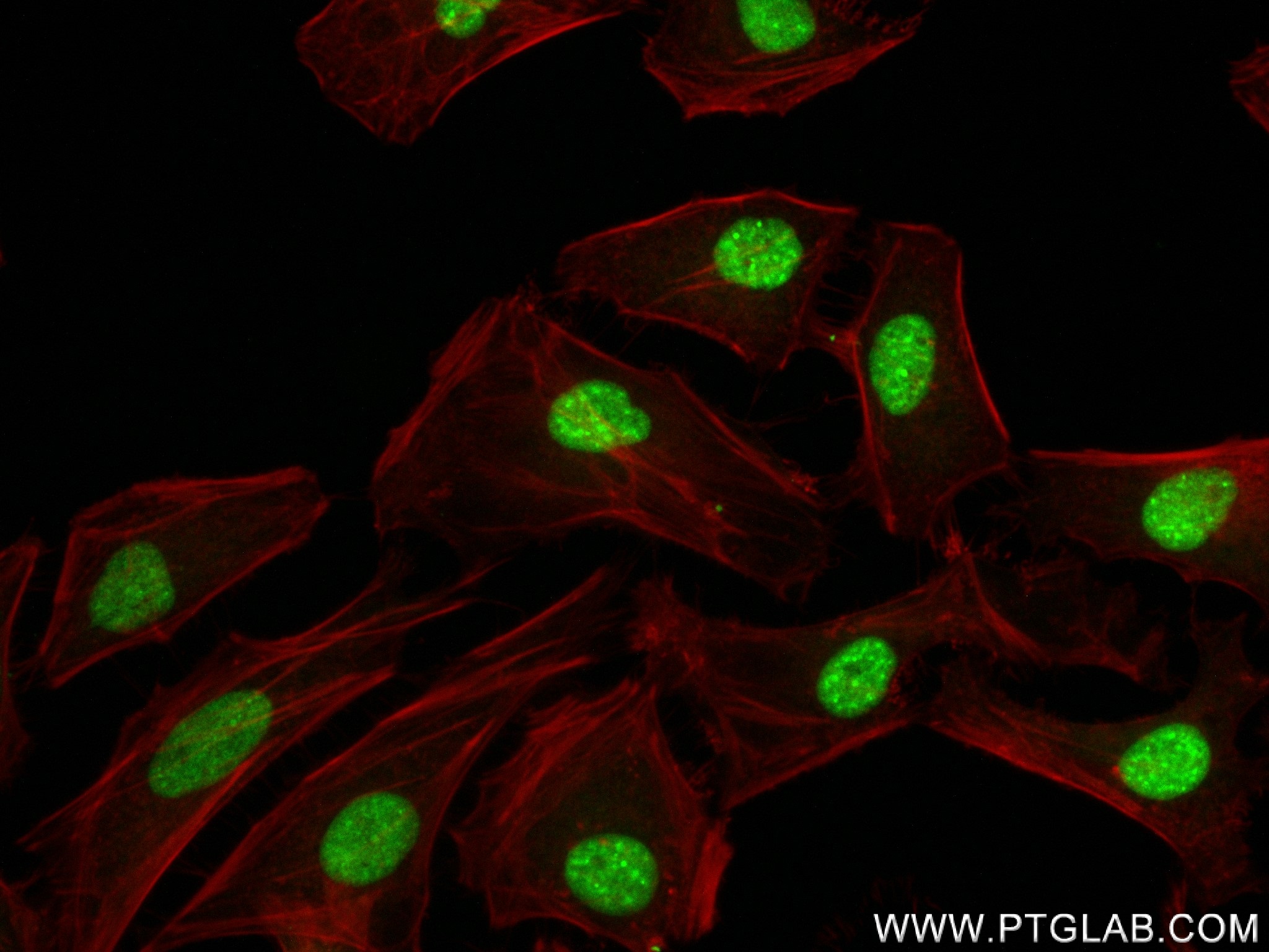 IF Staining of HeLa using 83805-4-RR