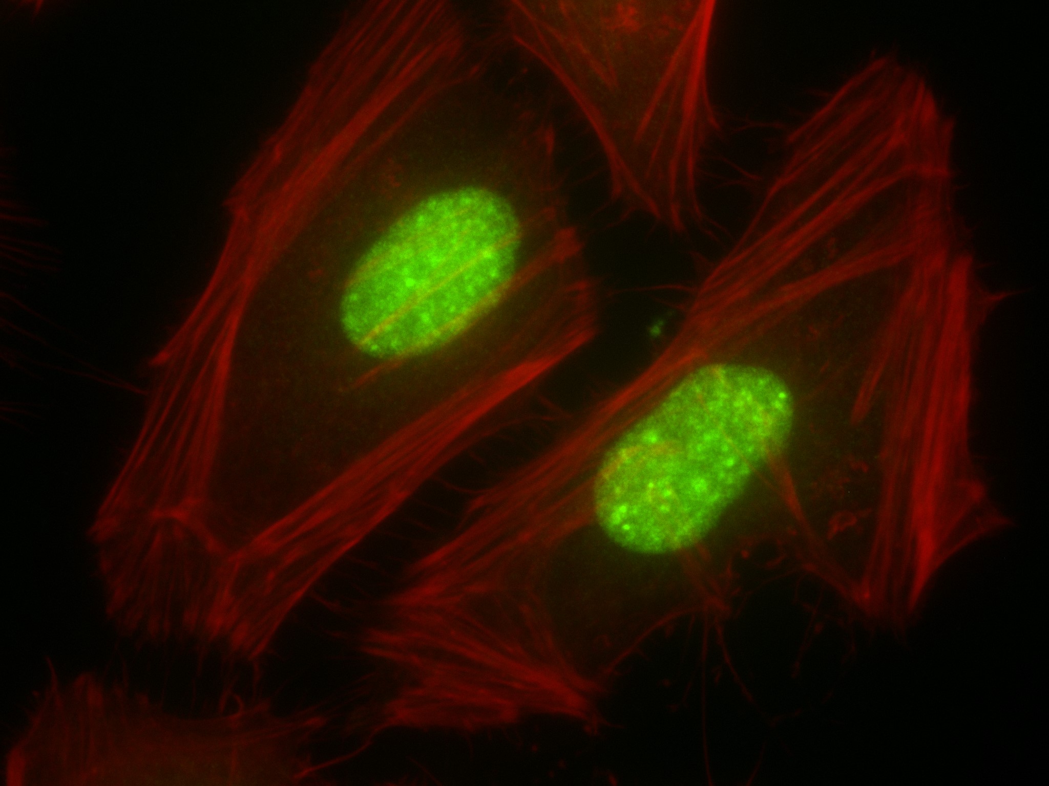 IF Staining of HeLa using 83805-4-RR