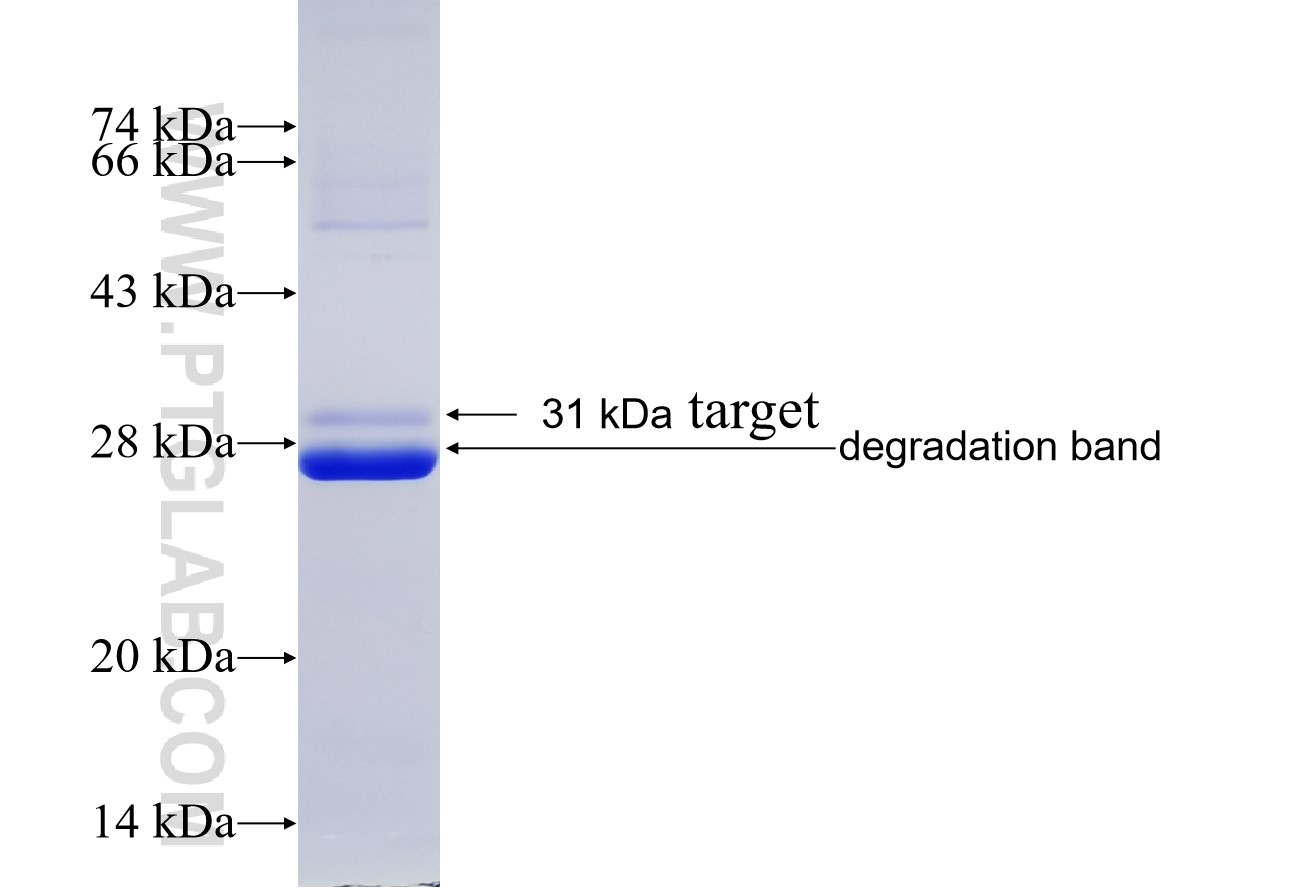 CSNK2B fusion protein Ag19180 SDS-PAGE