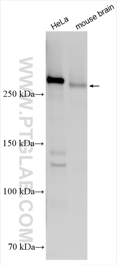 WB analysis using 31623-1-AP