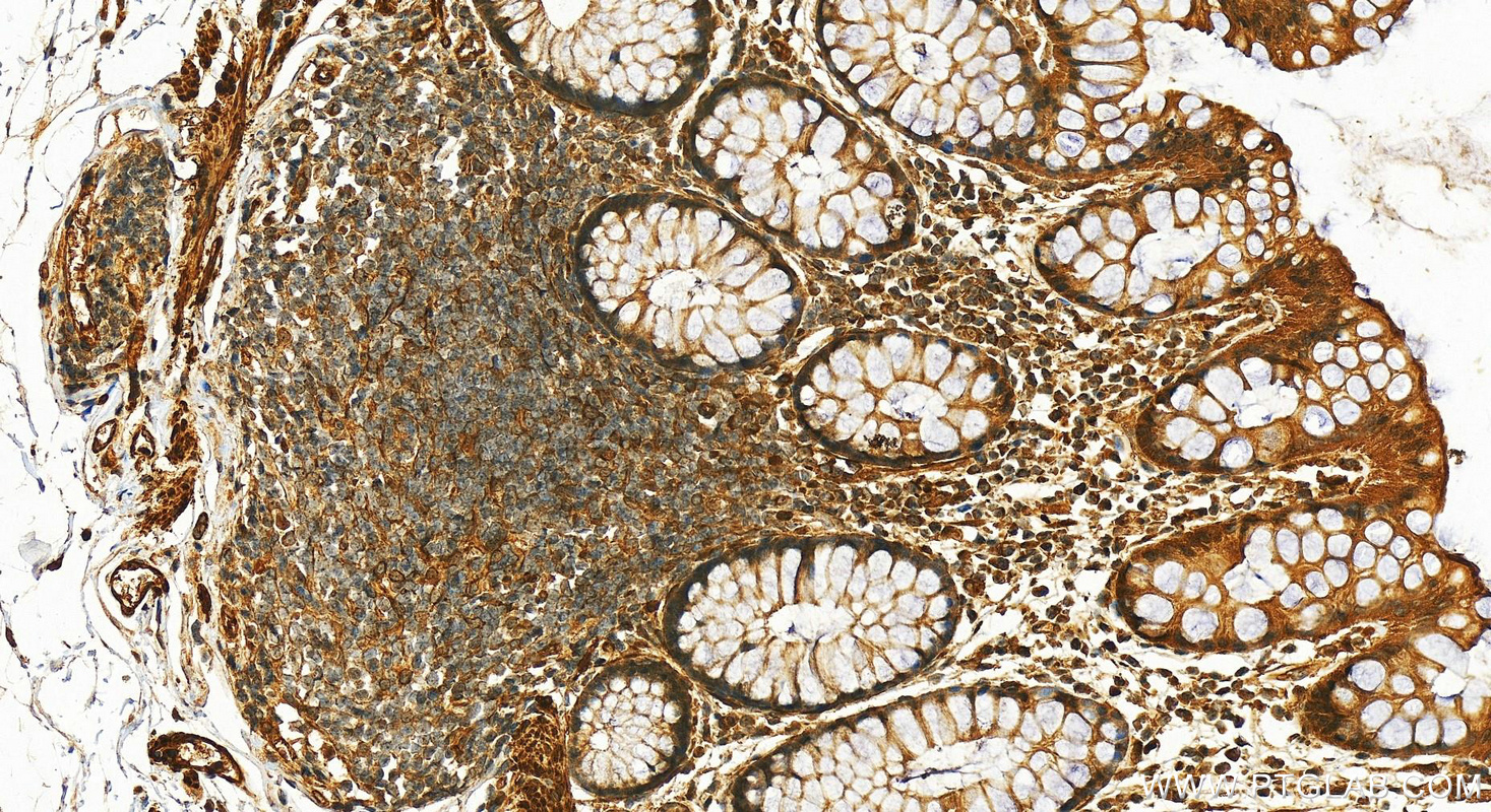 IHC staining of human normal colon using 13432-1-AP