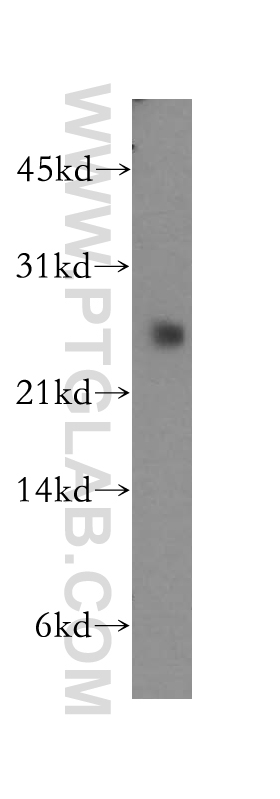 WB analysis of human stomach using 13432-1-AP