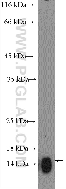 WB analysis of human saliva using 19935-1-AP