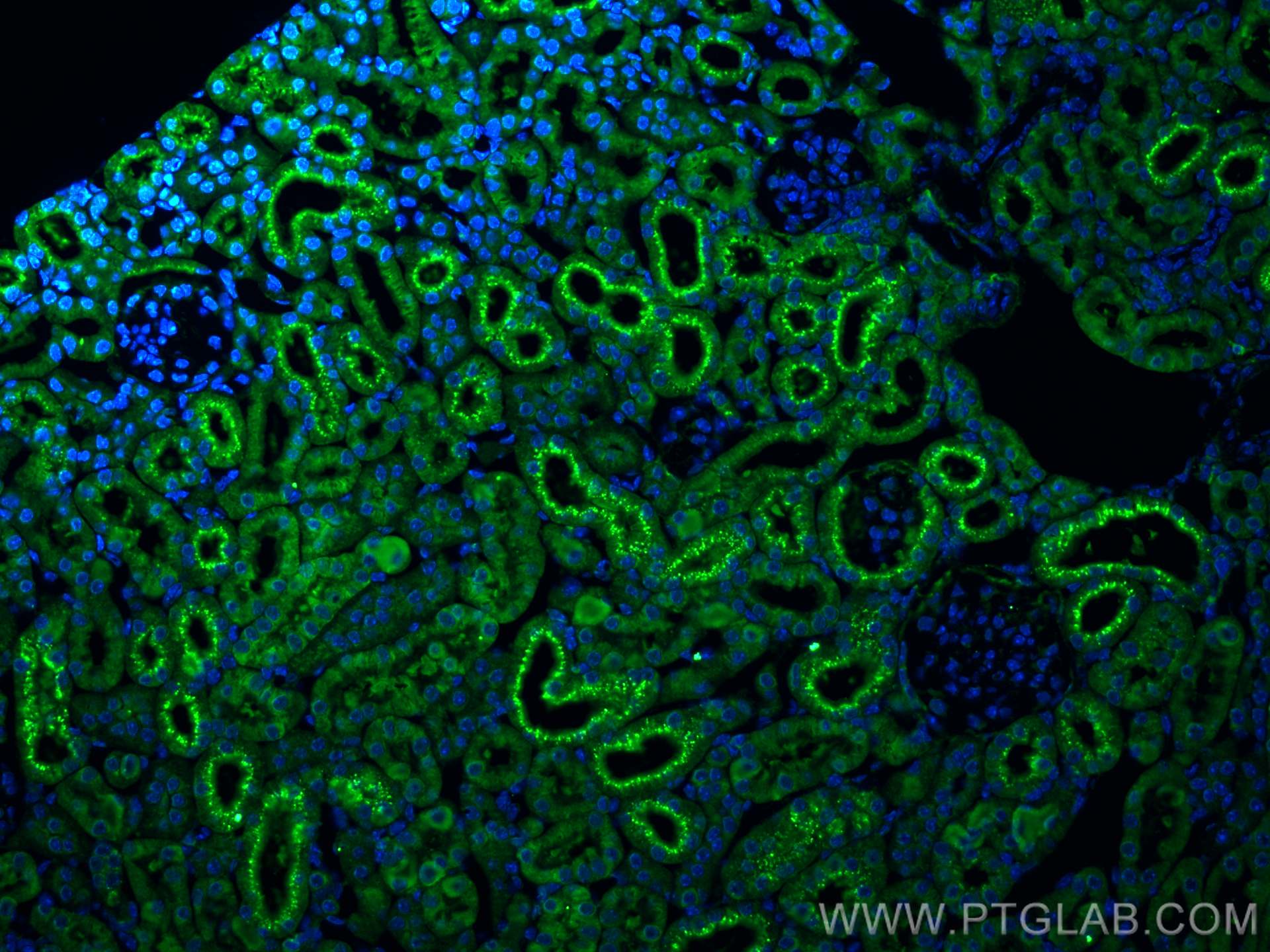 IF Staining of mouse kidney using 12245-1-AP