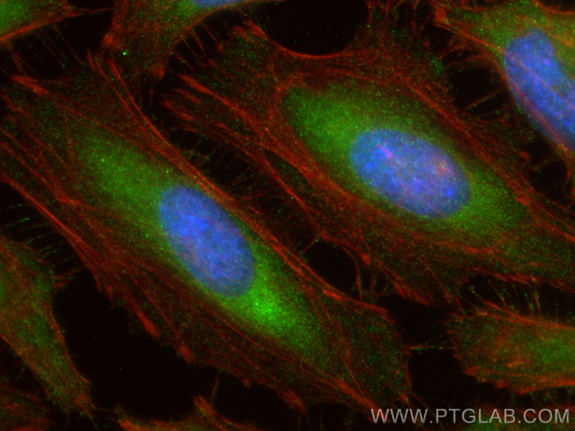 IF Staining of HeLa using 12245-1-AP