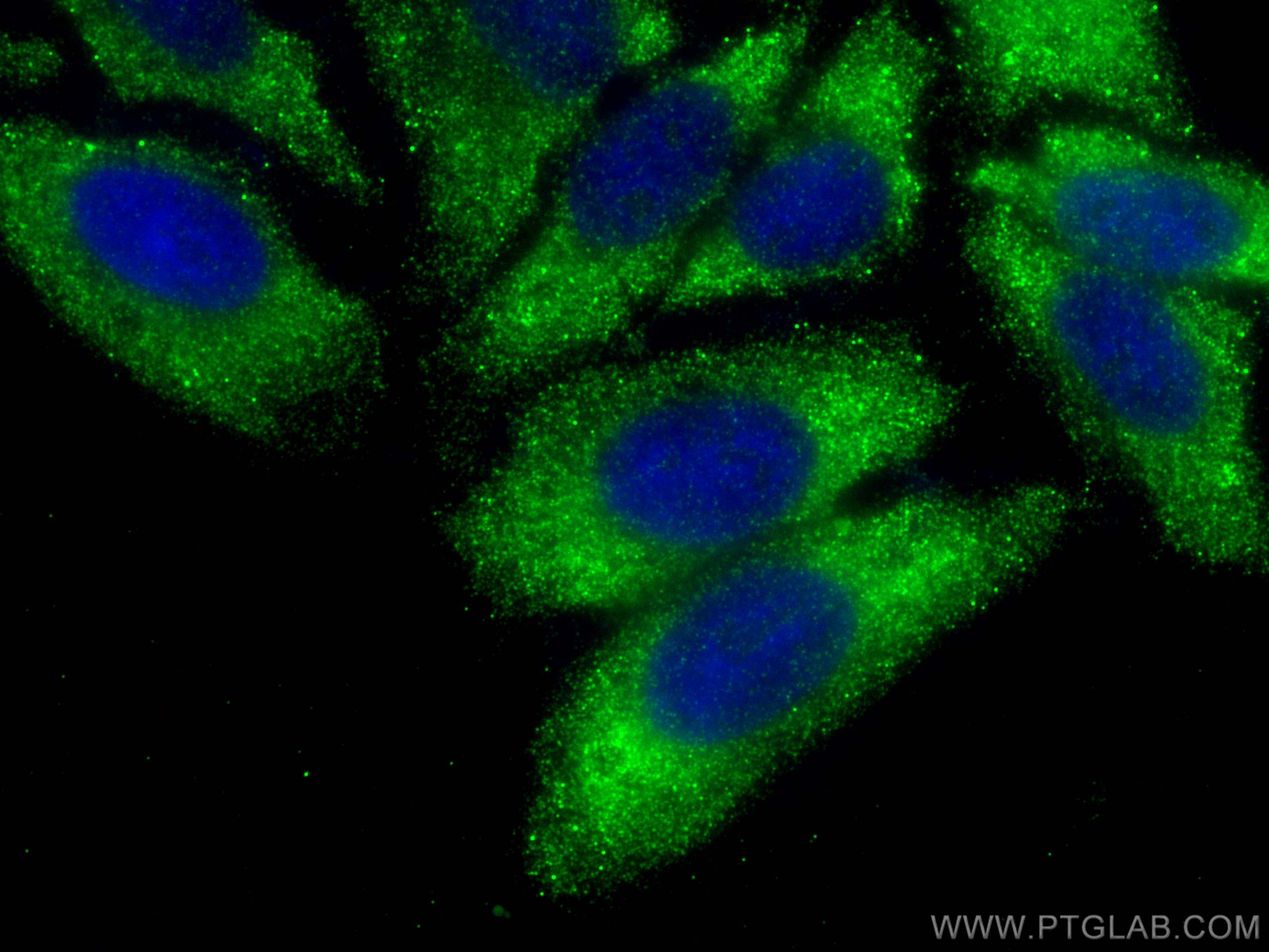 IF Staining of HepG2 using 15962-1-AP