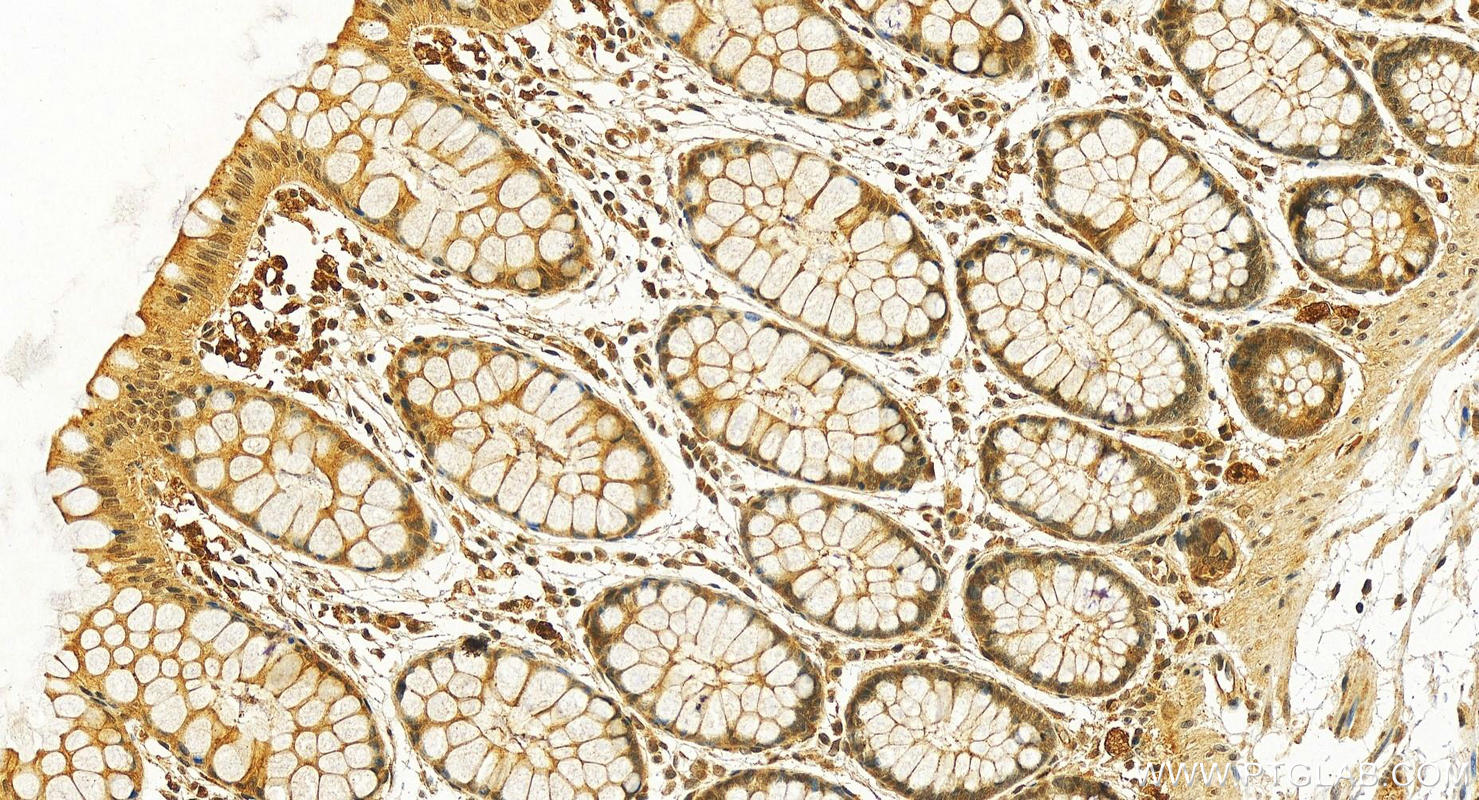 IHC staining of human colon using 10823-1-AP