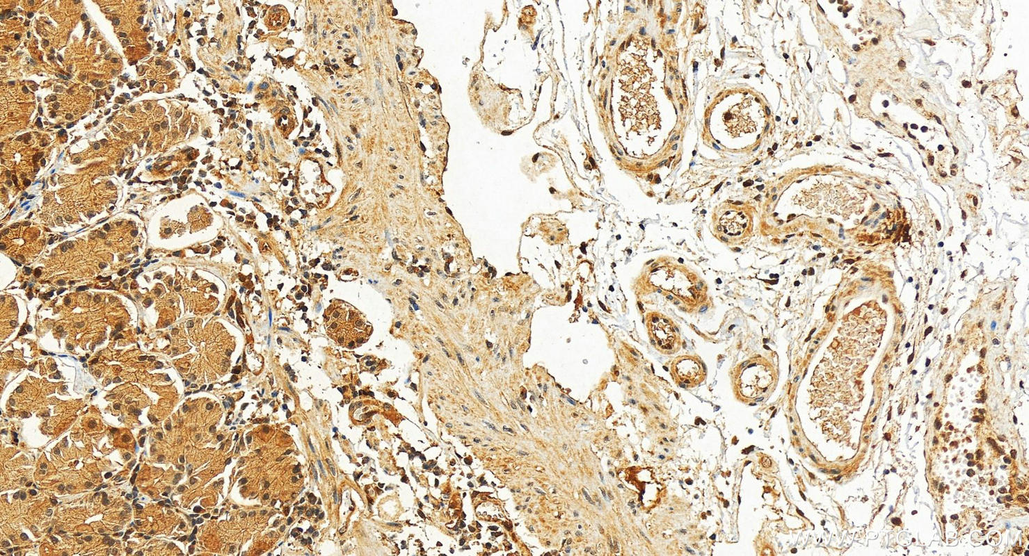 IHC staining of human stomach using 10823-1-AP