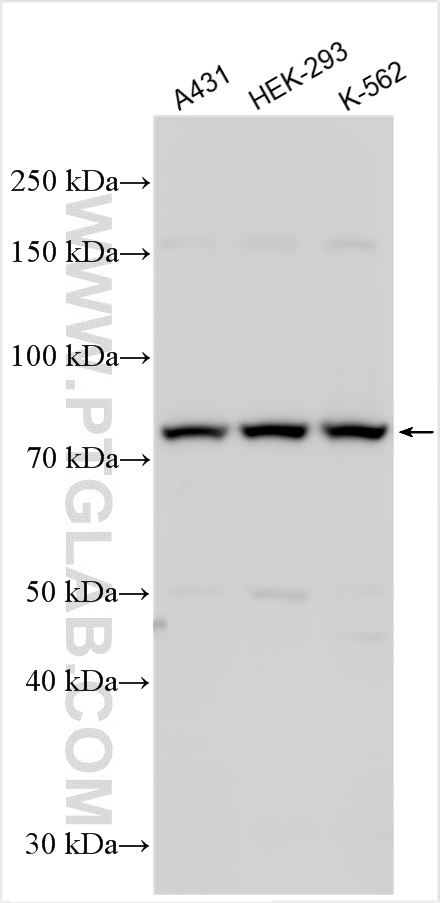 WB analysis using 24290-1-AP