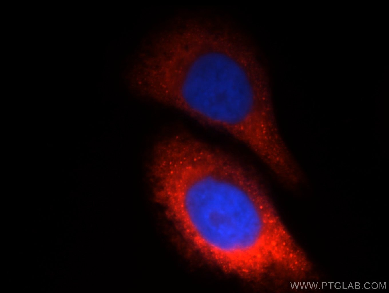 IF Staining of HepG2 using 12599-1-AP