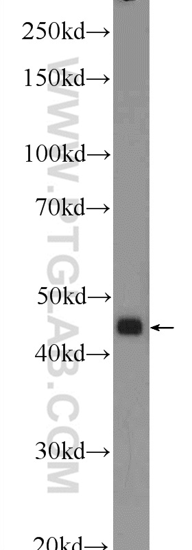 WB analysis of HeLa using 12599-1-AP