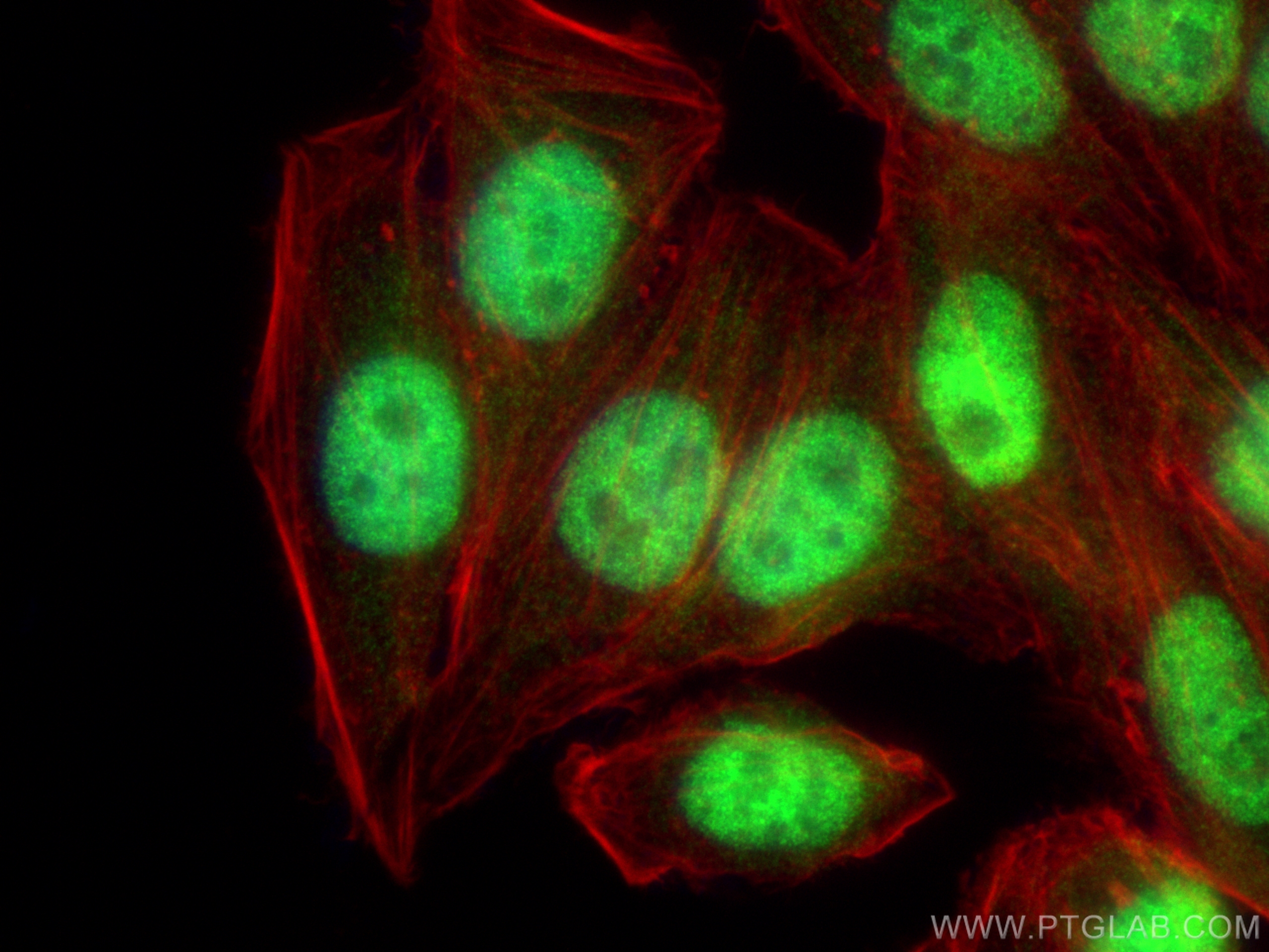 IF Staining of HepG2 using 30428-1-AP