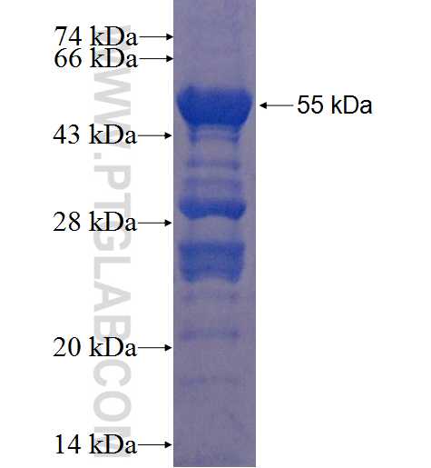 CTDSP1 fusion protein Ag1410 SDS-PAGE