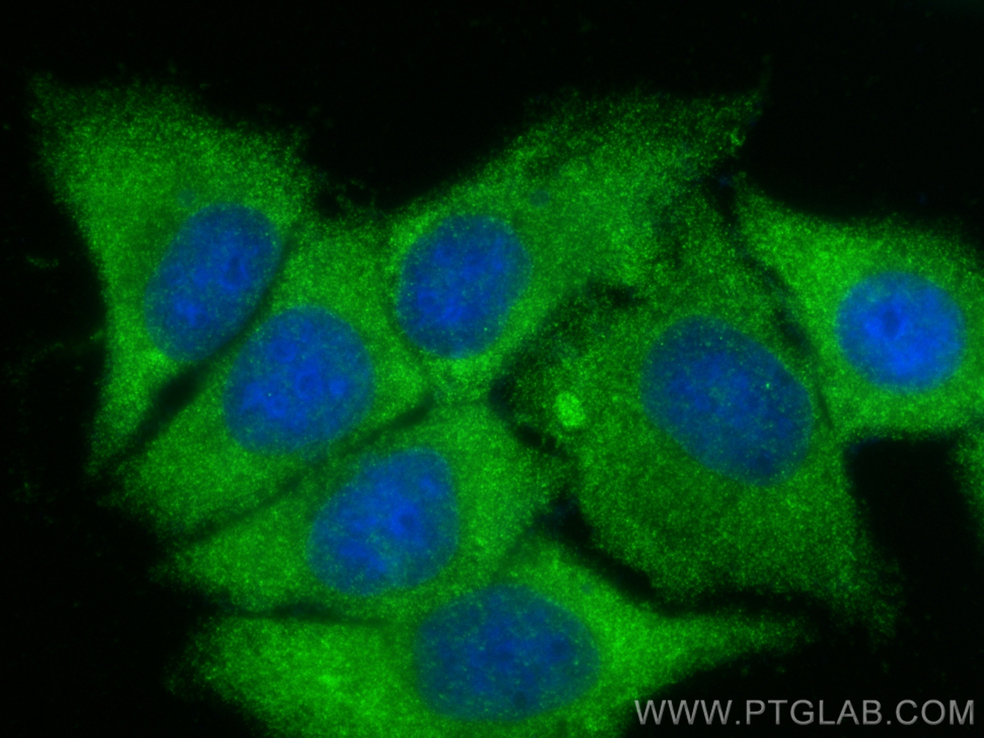 IF Staining of HepG2 using 12217-1-AP