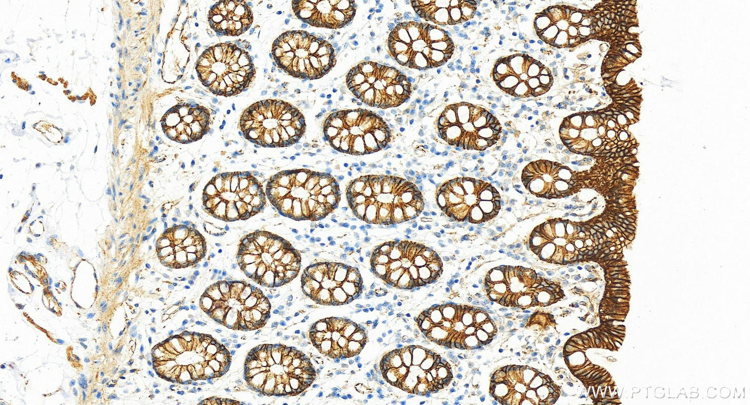 IHC staining of human colon using 12831-1-AP