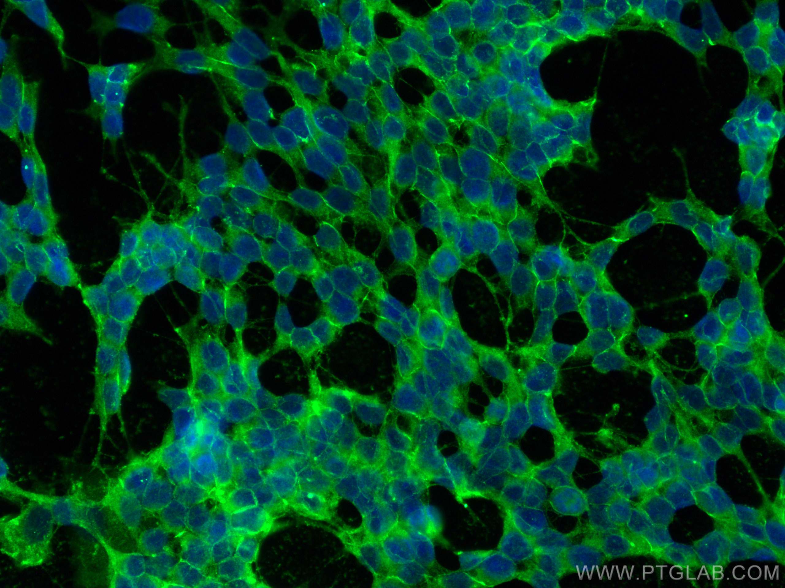 IF Staining of SH-SY5Y using 14362-1-AP