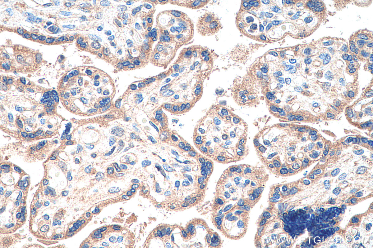 IHC staining of human placenta using 13974-1-AP